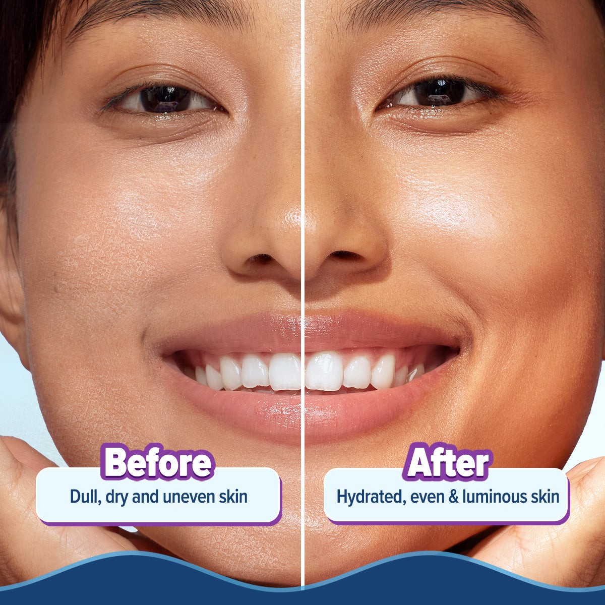 Before-and-after skin panel showing a smoother hydrated finish