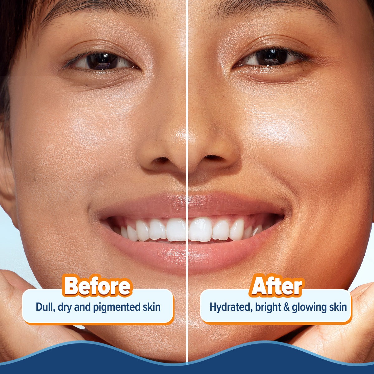 Before-and-after panel showing a fresher, hydrated skin look