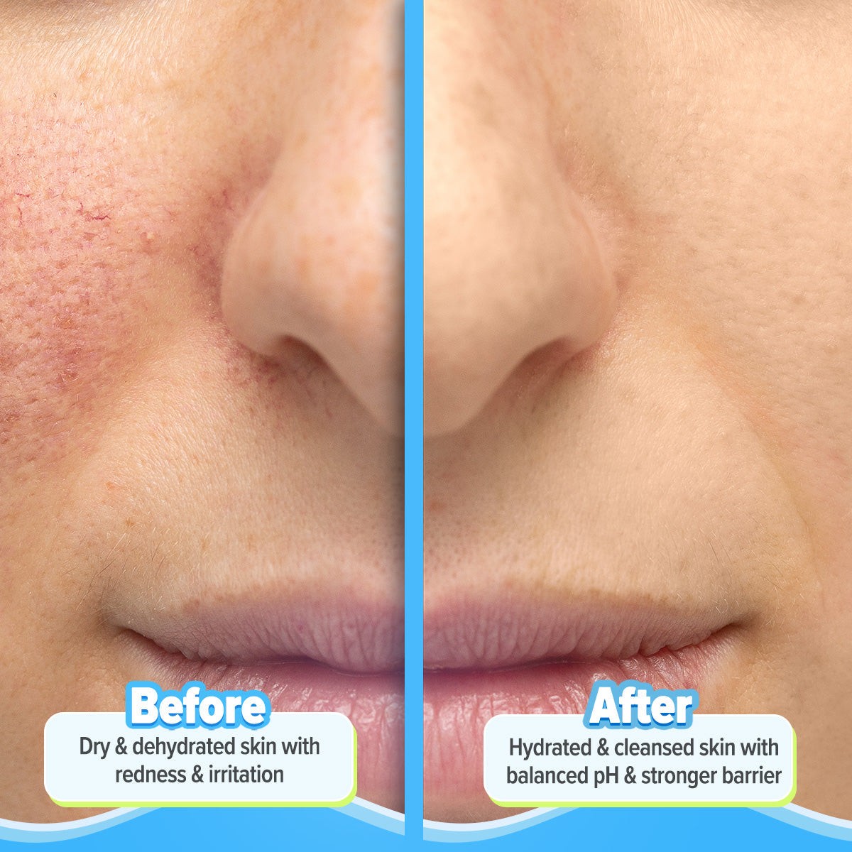 Barrier cleanser before after results